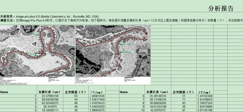 電鏡統計分析