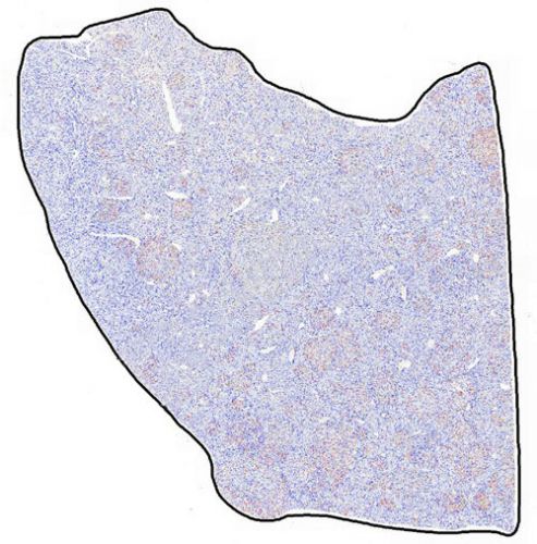 IHC切片AI分析（個(gè)數(shù)）