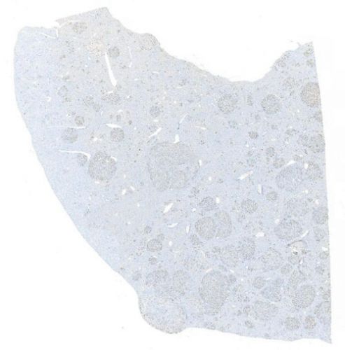 IHC切片AI分析（個(gè)數(shù)）